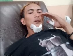 Seorang Wartawan Media Online di Karawang Dikeroyok Sejumlah Pemuda Tak Dikenal